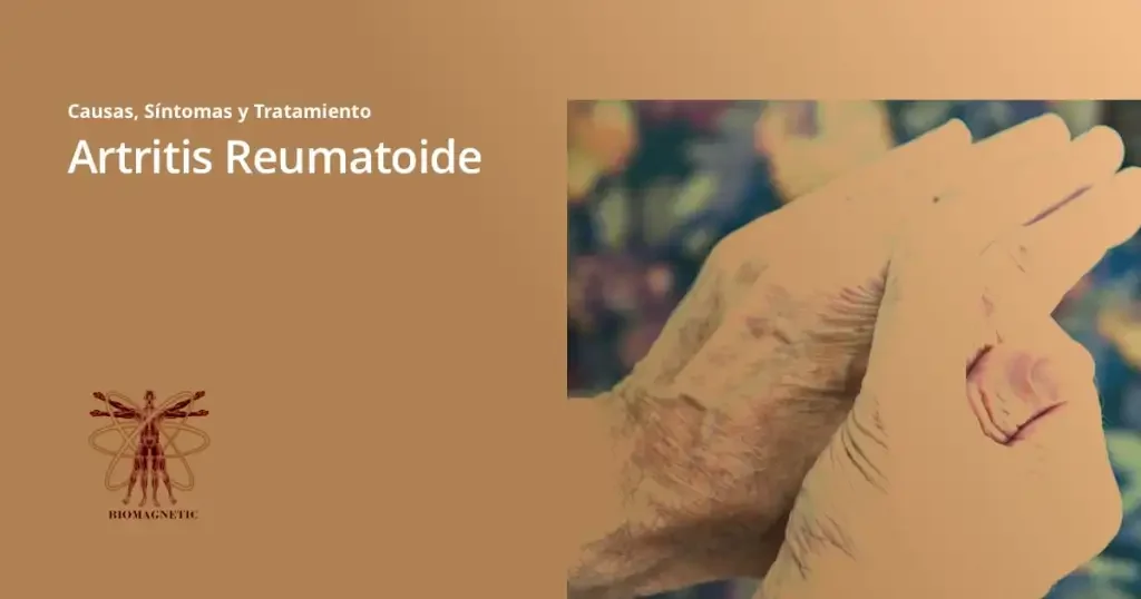 Biomagnetismo - Artritis Reumatoide